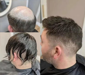 Prothèse capillaire pour hommes, 100% cheveux humains Remy, base australienne en dentelle et PU, avec raie droite, ondulations, nouée à la main - Product Image 5