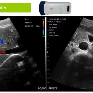 Sonde d'échographie numérique portable sans fil Doppler 128 éléments 3,5 MHz pour chien, mouton, cochon, sonde convexe WIFI Android IOS CU11 - Product Image 6