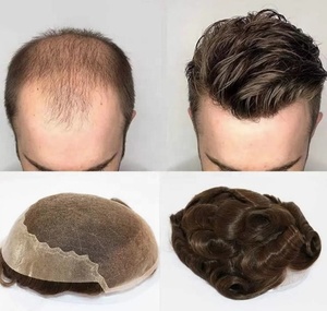 Tóc giả nam giả tóc thật Tóc giả nam tóc giả tóc giả tự nhiên cho người đàn ông da mỏng Brazil miếng tóc thay thế hệ thống - Product Image 6