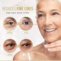 Masque hydratant à l'acide hyaluronique rafraîchissant pour les yeux, élimination des cernes, patchs pour les yeux dorés, tampon de gel