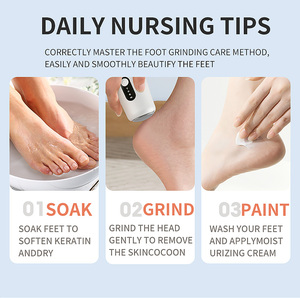 Exfoliante Eléctrico Portátil 3 en 1 <span class=keywords><strong>para</strong></span> Pies, con Carga USB, <span class=keywords><strong>para</strong></span> Uso Doméstico, Elimina la Piel Muerta - Product Image 3