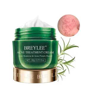 Breylee creme de tratamento para acne, creme de tratamento para remoção de acne e espinhas