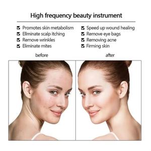 เครื่องนวดหน้าแบบพกพาสำหรับมืออาชีพ  กำลังไฟฟ้าสูง  รักษาสิว ยกกระชับผิวหน้า  สำหรับการดูแลผิวหน้าโดยเฉพาะ - Product Image 4