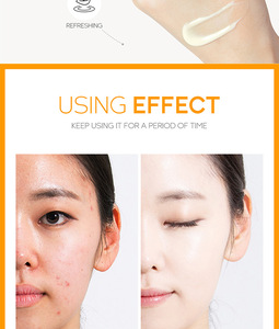 <span class=keywords><strong>Crema</strong></span> de Vitamina <span class=keywords><strong>C</strong></span> 40g, <span class=keywords><strong>Crema</strong></span> Hidratante para la Piel, Producto para el Cuidado Facial, <span class=keywords><strong>Crema</strong></span> para el Cuidado de la Piel, Fabricante, Venta al por Mayor - Product Image 5