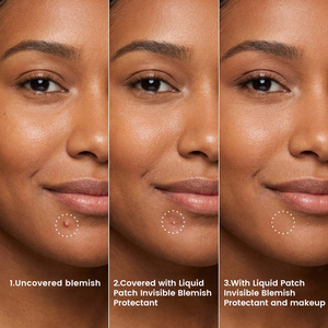 Parches Líquidos para Imperfecciones MELAO, Control de Grasa, Película Transparente Invisible para Granos, Gel No Graso para el Cuidado de la Piel con BHA - Product Image 5