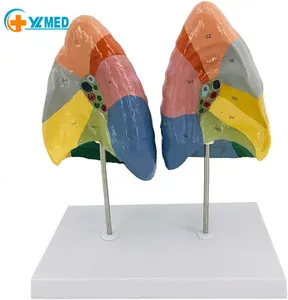 Human lung segment model Respiratory system lung segment model medical student gift model