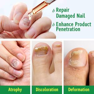 Huile de soin des cuticules au gingembre végétal naturel de qualité supérieure Traitements des ongles à base de plantes pour renforcer les ongles et favoriser leur croissance - Product Image 5