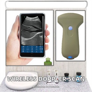 Escáner de Ultrasonido Doppler Color Inalámbrico USB EOMED 80E con Sonda Convexa de 3.2MHz/4MHz y Sonda Lineal de 7.5/10MHz, Veterinario o Humano - Product Image 1