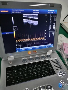 <span class=keywords><strong>Precio</strong></span> Más Bajo para Laptop con Máquina <span class=keywords><strong>de</strong></span> Ultrasonido Doppler 3D para Uso Veterinario en Perros SUN-800F2 - Product Image 5
