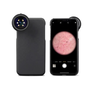 Iboo डी-300 उच्च परिभाषा चिकित्सा इलेक्ट्रॉनिक 6x त्वचा कैंसर के लिए - Product Image 4