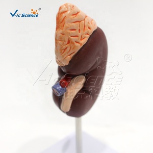 Modelo de Disección Renal de PVC, Tamaño <span class=keywords><strong>Natural</strong></span>, con Calices y Ureter, para Laboratorio de Habilidades de Enfermería, con Certificaciones CE, ISO, ROHS y CNAS - Product Image 4