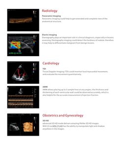 De Kleur Doppler Ultrasone Machine Wordt Standaard Geleverd Met Convexe En Lineaire Array Sondes Met 4d Software Voor Gratis Mslcu48 - Product Image 5