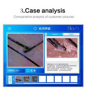 Trichoscope de Bureau Intelligent pour l'Analyse du Cuir Chevelu et la Détection des Cheveux, Caméra IA HD pour l'Examen des Follicules Pileux - Product Image 2