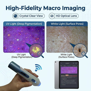 Analizador de Piel Inteligente con IA, Detector de Piel Digital Inalámbrico, <span class=keywords><strong>Microscopio</strong></span> Digital, Escáner Profesional para el Cuidado de la Piel en Salones de Belleza - Product Image 2