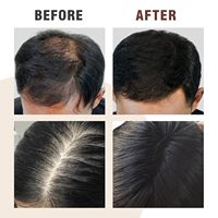 Champú OEM&ODM de Polygonum Anticaída, Anticaspa, Refrescante para el Cuero Cabelludo, Estimula el Crecimiento del Cabello, Apto para Cabello Rizado