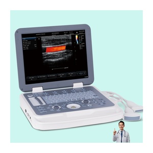 Ecógrafo Portátil Ultra-HD N30 con <span class=keywords><strong>Doppler</strong></span> Color 2D para Exámenes Humanos, Veterinarios, de Embarazo y Abdominales - Product Image 1
