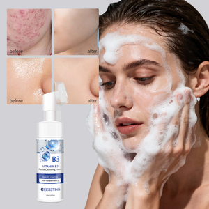 Gel Exfoliante Facial OEM/ODM, Limpiador Facial Iluminador, Hidratante, Elimina Piel Muerta y Puntos Negros - Product Image 1