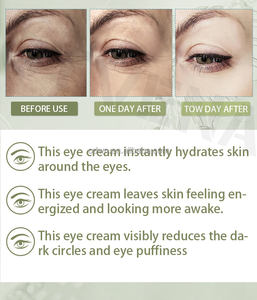 Ensemble de crème naturelle anti-âge raffermissante pour les yeux de Corée, marque privée - Product Image 5