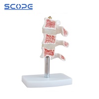 Instrumento de enseñanza de maniquí médico, simulador anatómico de esqueleto, modelo de osteoporosis humana de 3 vértebras, SC-A1022