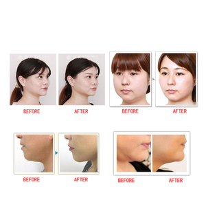 Prodotto per la Cura della Pelle e la Bellezza 2021: Maschera Viso Contenitiva per Doppio Mento con Fascia Modellante e Trattamento Rassodante - Product Image 5