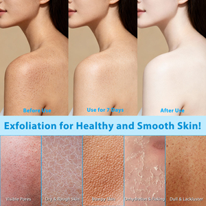 IKZEE สติ๊กผลัดเซลล์ผิวเรียบเนียนด้วยกรดไกลโคลิก สครับผิวกายด้วยกรดซาลิไซลิก สำหรับทุกสภาพผิว สติ๊กผลัดเซลล์ผิวกายด้วยกรดไกลโคลิก - Product Image 3