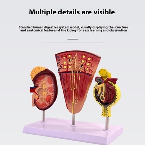 Unidad Renal y Modelo Glomerular Estructura Anatómica del Sistema Urinario Modelo de Riñón Humano Modelo Anatómico Renal - Product Image 5