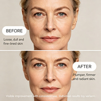 Serum Wajah Private Label Volufiline Pro-Xylane Plumping Anti Aging, Mengencangkan, Melembapkan, untuk Perawatan Kulit Sehari-hari