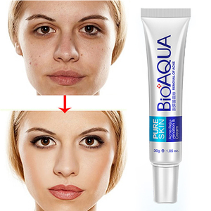 BIOAOUA Crema Sbiancante Viso 30g, Trattamento per Acne e Cicatrici, Idratante con Glicerina, Crema Rimozione Acne - Product Image 3