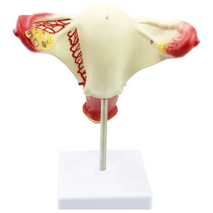Modelo anatómico de útero vaginal con dispositivo de valor endógeno <span class=keywords><strong>femenino</strong></span> - Product Image 5