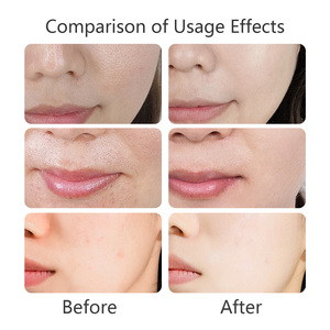 Limpiador <span class=keywords><strong>Facial</strong></span> Exfoliante Suave, Ilumina el Tono de la Piel, Purifica los Poros, No Reseca, Elimina Puntos Negros y Controla la Grasa - Product Image 4