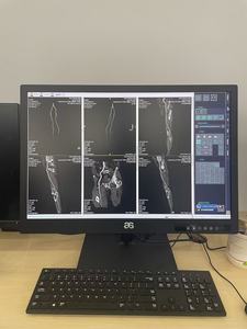 Nuevo Monitor Médico DICOM de 30 Pulgadas y 6 Megapíxeles con Pantalla Vertical en Escala de Grises para Lectura de Tomografía Computarizada, Radiología y Diagnóstico Veterinario - Product Image 4
