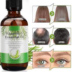 Aceite de Romero para el crecimiento del cabello 100% aceite de Romero prensado en frío natural para aromaterapia de la piel para mujeres y hombres - Product Image 3