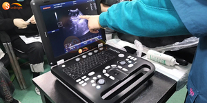 Ecógrafo Doppler Color Veterinario Profesional JM-906A HD para Detección <span class=keywords><strong>de</strong></span> <span class=keywords><strong>Enfermedades</strong></span> en Animales <span class=keywords><strong>de</strong></span> Granja - Product Image 5