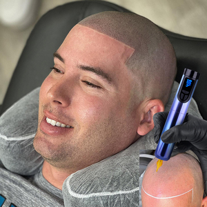 Kit de machine à tatouer SMP OEM personnalisé, fournitures de micropigmentation du <span class=keywords><strong>cuir</strong></span> <span class=keywords><strong>chevelu</strong></span>, stylo de <span class=keywords><strong>tatouage</strong></span> capillaire pour hommes - Product Image 1