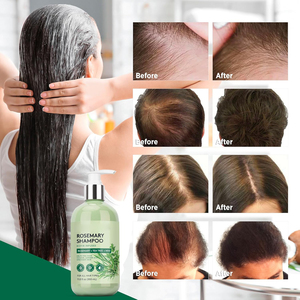 Champú en <span class=keywords><strong>Crema</strong></span> Orgánico para Engrosar el Cabello <span class=keywords><strong>con</strong></span> Romero y Aceite de Argán, Fórmula Nutritiva y Anticaspa para Hombres y Mujeres (2 en 1) - Product Image 2