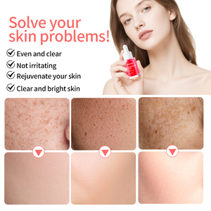 Niacinamide 10% TXA 4% siero per il viso per la rimozione delle macchie scure cicatrici da Acne e la pelle illuminante commercio all'ingrosso - Product Image 3