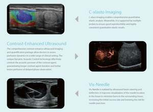 Appareil d'échographie Doppler couleur Sonoscape P12Elite 4D avec fonction IA et grand écran pour l'obstétrique/la cardiologie/l'abdomen - Product Image 4