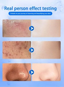 Professional Oxygen Facial Machine With Oxygen Jet Dome for Salon Spa Use Portable <strong>Beauty</strong> Equipment <strong>Hyperbaric</strong> Oxygen <strong>Chamber</strong> - Product Image 5