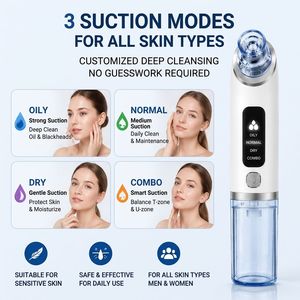 Removedor de Puntos Negros Eléctrico Z, Limpiador Facial con Succión al Vacío, Rejuvenecimiento de la Piel, 6 Cabezales de Succión - Product Image 2