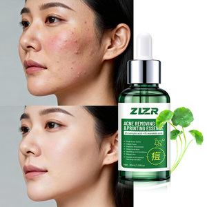 Sérum Liquide Réparateur de Barrière Cutanée Anti-Marques d'Acné à l'Hyaluronate de Sodium, Acide Salicylique, Acide Mandélique et Madécassoside, Marque Blanche en Gros - Product Image 6