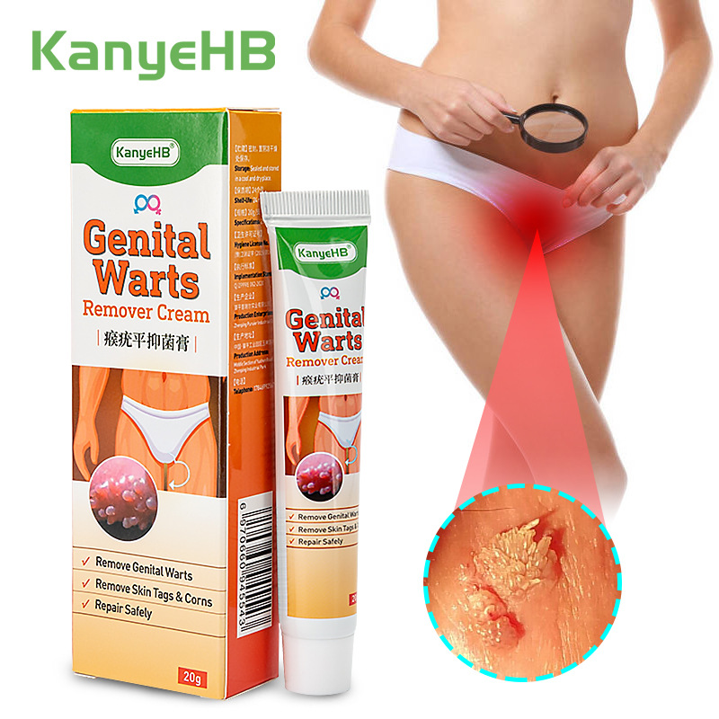 Hot Sales 20g KanyeHB Removal of Skin Warts Ointment Genital Wart Treatment PapillomasTags Removing Against Moles Remover