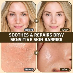 Baume au suif de bœuf biologique nourri à l'herbe et au miel avec vitamine E <span class=keywords><strong>pour</strong></span> le visage et le corps – Crème hydratante et nourrissante <span class=keywords><strong>pour</strong></span> tous types de peau - Product Image 3