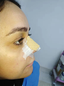 <span class=keywords><strong>Aquaplast</strong></span>-láminas de férula Nasal, férula termoplástica externa para la nariz, rinoplastia, cuidado de la nariz - Product Image 4