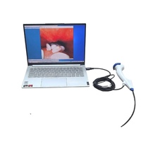 Endoscope vétérinaire USB Portable gastro-intestinal urétéroscopie bronchoscopie pyéloscopie équipement médical endoscope flexible