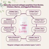 Cápsulas de Gel Suave con Complejo Multicolágeno OEM, 240 Cápsulas, Ácido Hialurónico Tipo I, II, III, V, X, Vitamina C, Suplementos Herbales para Adultos y Recién Nacidos