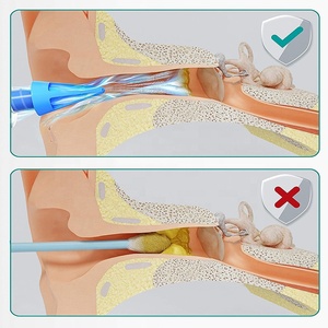 Venta al por mayor de silicona Punta de irrigación arandela de oído jeringa <span class=keywords><strong>cera</strong></span> lavado de oído herramienta de limpieza Kit logotipo personalizado - Product Image 5