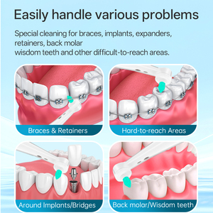 Têtes de <span class=keywords><strong>brosse</strong></span> à dents électriques magnétiques de remplacement haute performance ODM en gros pour les soins orthodontiques de la série IO - Product Image 3