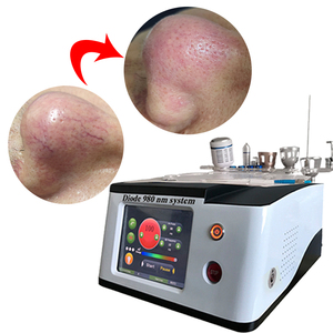 Máquina Láser de Diodo de Alta Calidad de 980nm 6+1 para Eliminación Vascular, Tratamiento de <span class=keywords><strong>Eccema</strong></span> y Herpes, Máquina de Fisioterapia para el Cuerpo - Product Image 3