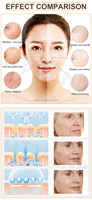 Crème pour le visage anti-rides instantanée à effet tenseur en 2 minutes, marque privée OTVENA