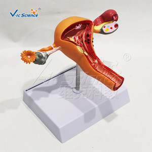 Modelo patológico uterino femenino, modelo anatómico de órgano reproductor ginecológico, molde para enseñanza y formación médica. - Product Image 3